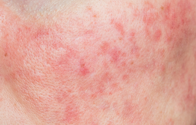 Sensitive Skin Guide (available in russin language only)